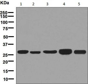 Western blot - Anti-MRPL28 antibody [EPR7578(B)] (AB126719)
