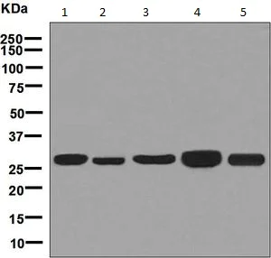 Western blot - Anti-MRPL28 antibody [EPR7578(B)] (AB126719)