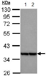 Western blot - Anti-MRPL3 antibody (AB151326), expandable thumbnail