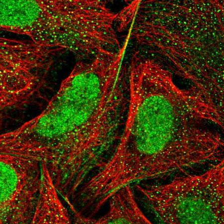 Immunocytochemistry/ Immunofluorescence - Anti-MRPL34 antibody (AB151055)