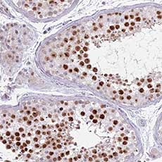Immunohistochemistry (Formalin/PFA-fixed paraffin-embedded sections) - Anti-MRPL34 antibody (AB151055)