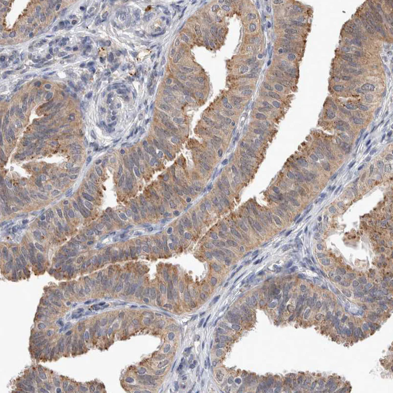 Immunohistochemistry (Formalin/PFA-fixed paraffin-embedded sections) - Anti-MRPL37 antibody (AB224467)