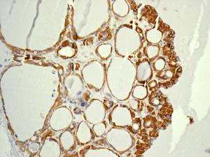 Immunohistochemistry (Formalin/PFA-fixed paraffin-embedded sections) - Anti-MRPL4 antibody [EPR13151] - BSA and Azide free (AB250169)