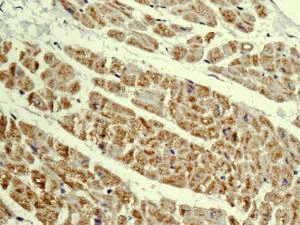 Immunohistochemistry (Formalin/PFA-fixed paraffin-embedded sections) - Anti-MRPL4 antibody [EPR13151] - BSA and Azide free (AB250169)