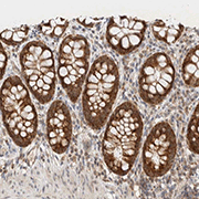 Immunohistochemistry (Formalin/PFA-fixed paraffin-embedded sections) - Anti-MRPL41 antibody (AB121821)
