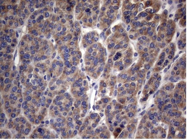 Immunohistochemistry (Formalin/PFA-fixed paraffin-embedded sections) - Anti-MRPL42 antibody [OTI1A4] (AB279370)