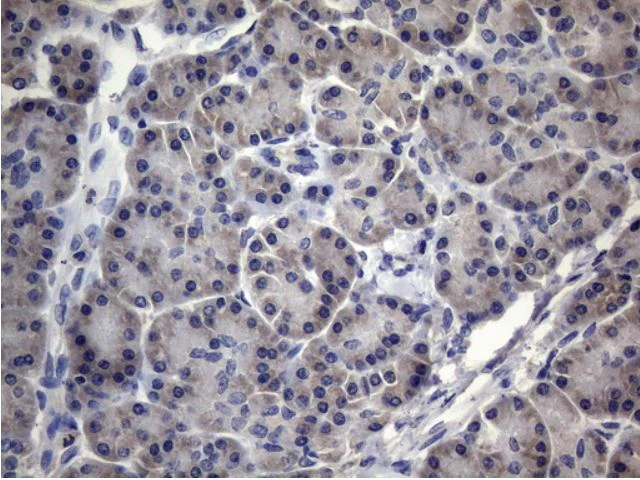 Immunohistochemistry (Formalin/PFA-fixed paraffin-embedded sections) - Anti-MRPL42 antibody [OTI1A4] (AB279370)