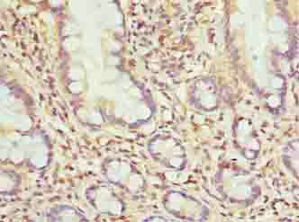 Immunohistochemistry (Formalin/PFA-fixed paraffin-embedded sections) - Anti-MRPL51 antibody (AB235828)