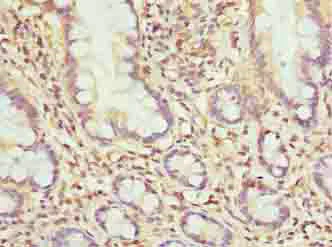 Immunohistochemistry (Formalin/PFA-fixed paraffin-embedded sections) - Anti-MRPL51 antibody (AB235828)