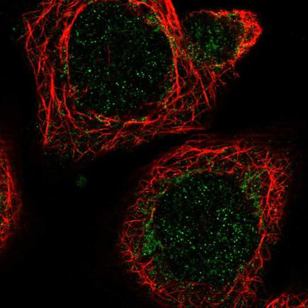 Immunocytochemistry/ Immunofluorescence - Anti-MRPL51 antibody (AB243821)