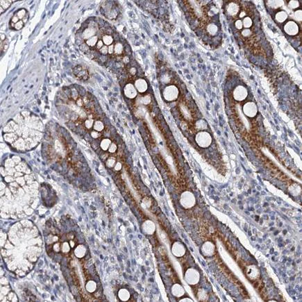 Immunohistochemistry (Formalin/PFA-fixed paraffin-embedded sections) - Anti-MRPL51 antibody (AB243821)