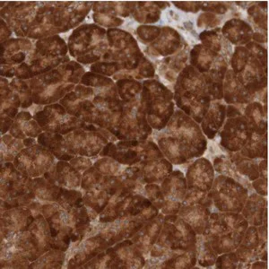 Immunohistochemistry (Formalin/PFA-fixed paraffin-embedded sections) - Anti-MRPL52 antibody (AB121366)