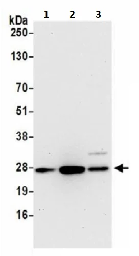 Western blot - Anti-MRPS15 antibody (AB242120)