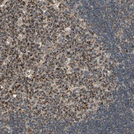 Immunohistochemistry (Formalin/PFA-fixed paraffin-embedded sections) - Anti-MRPS22 antibody (AB224341)