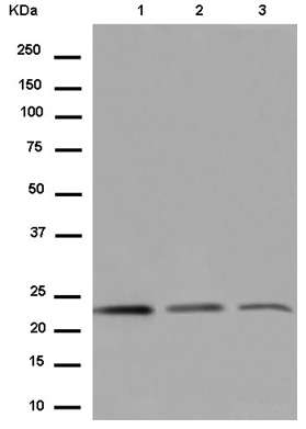 Western blot - Anti-MRPS26 antibody [EPR14396-90] (AB185233), expandable thumbnail