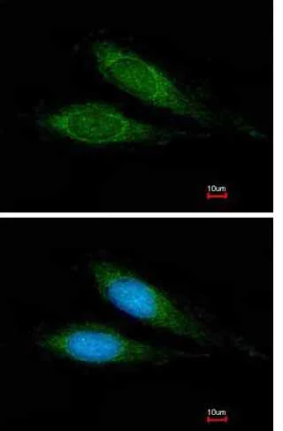 Immunocytochemistry/ Immunofluorescence - Anti-MRPS27 antibody (AB153940)