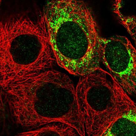 Immunocytochemistry/ Immunofluorescence - Anti-MRPS7 antibody (AB224442), expandable thumbnail