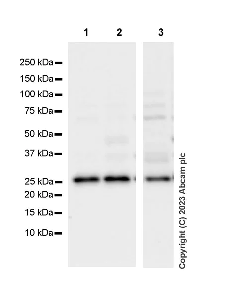 Anti-MRRF antibody [EPR14140(B)] (ab181223) | Abcam