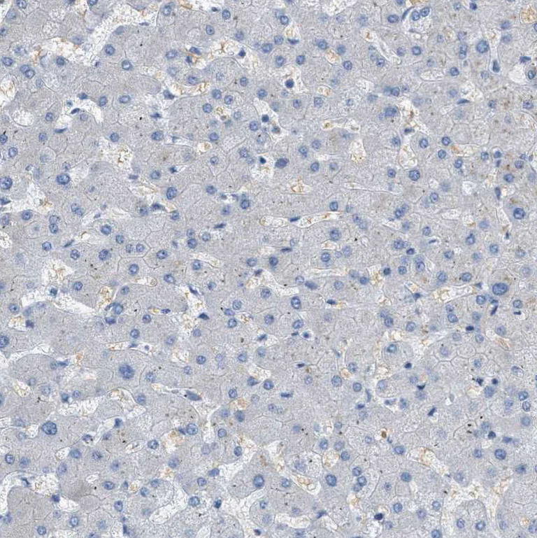 Immunohistochemistry (Formalin/PFA-fixed paraffin-embedded sections) - Anti-MRS2/HPT antibody (AB246915)