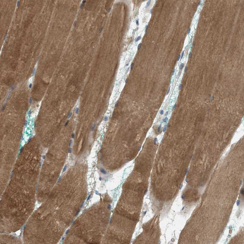 Immunohistochemistry (Formalin/PFA-fixed paraffin-embedded sections) - Anti-MRS2/HPT antibody (AB246915)