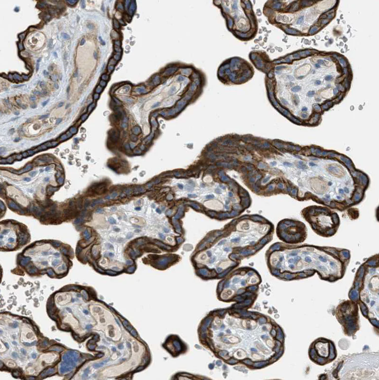 Immunohistochemistry (Formalin/PFA-fixed paraffin-embedded sections) - Anti-MRS2/HPT antibody (AB246915)