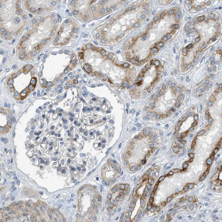 Immunohistochemistry (Formalin/PFA-fixed paraffin-embedded sections) - Anti-MRS2/HPT antibody (AB246915)