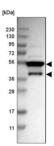 Western blot - Anti-MRS2/HPT antibody (AB246915)