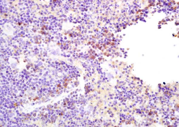 Immunohistochemistry (Formalin/PFA-fixed paraffin-embedded sections) - Anti-MS2 antibody (AB214225)