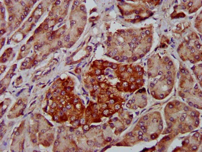 Immunohistochemistry (Formalin/PFA-fixed paraffin-embedded sections) - Anti-MS2 antibody (AB236949)