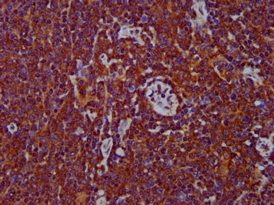 Immunohistochemistry (Formalin/PFA-fixed paraffin-embedded sections) - Anti-MS2 antibody (AB236949), expandable thumbnail