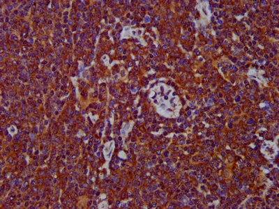 Immunohistochemistry (Formalin/PFA-fixed paraffin-embedded sections) - Anti-MS2 antibody (AB236949)