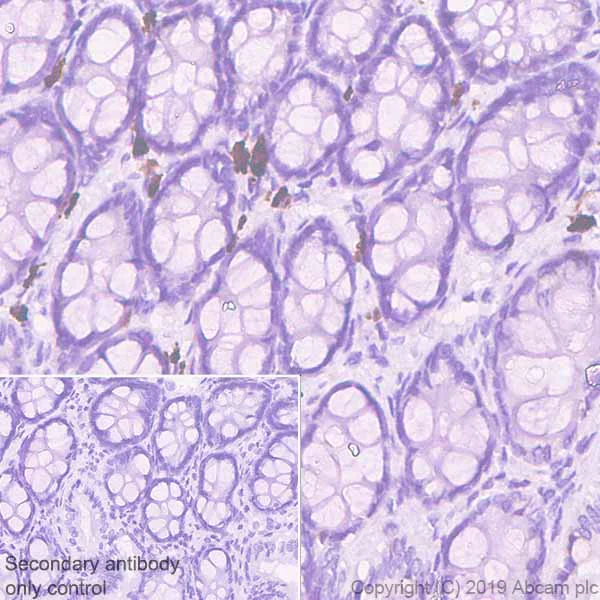 Immunohistochemistry (Formalin/PFA-fixed paraffin-embedded sections) - Anti-MS2 antibody [EPR22688-44] (AB255608)