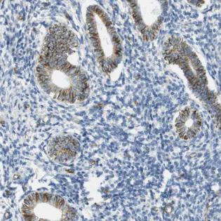 Immunohistochemistry (Formalin/PFA-fixed paraffin-embedded sections) - Anti-MS4A10 antibody - N-terminal (AB188257)