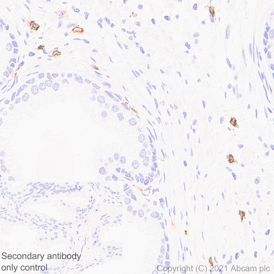 Immunohistochemistry (Formalin/PFA-fixed paraffin-embedded sections) - Anti-MS4A2 antibody [EPR24324-7] (AB271068)