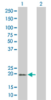 Western blot - Anti-MS4A4A antibody (AB67134), expandable thumbnail