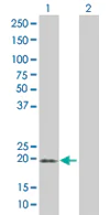 Western blot - Anti-MS4A4A antibody (AB67134)