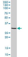 Western blot - Anti-MS4A4A antibody (AB67134), expandable thumbnail