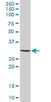 Western blot - Anti-MS4A4A antibody (AB67134)