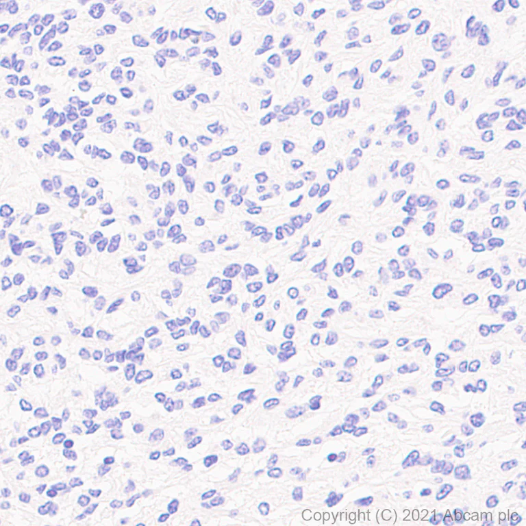 Immunohistochemistry (Formalin/PFA-fixed paraffin-embedded sections) - Anti-MS4A4A antibody [EPR24399-144] (AB271069)