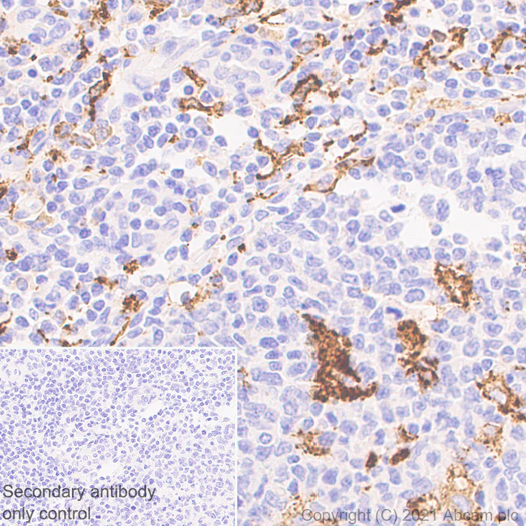 Immunohistochemistry (Formalin/PFA-fixed paraffin-embedded sections) - Anti-MS4A4A antibody [EPR24399-144] (AB271069)