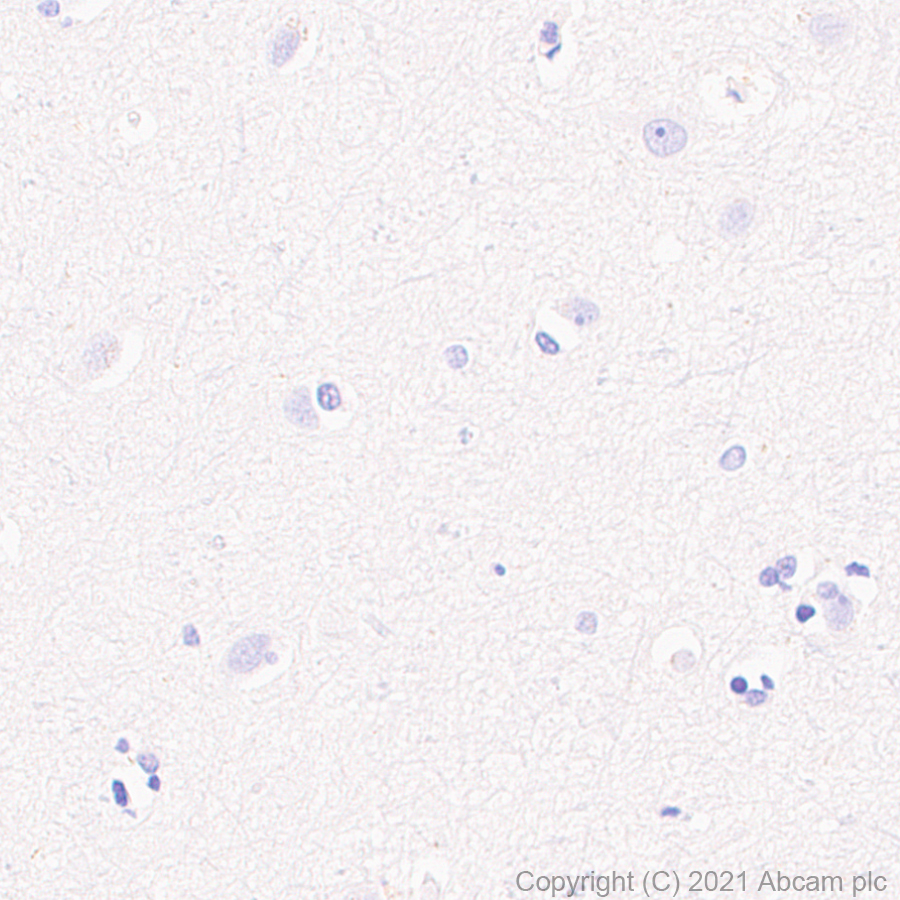 Immunohistochemistry (Formalin/PFA-fixed paraffin-embedded sections) - Anti-MS4A4A antibody [EPR24399-144] - BSA and Azide free (AB281837)