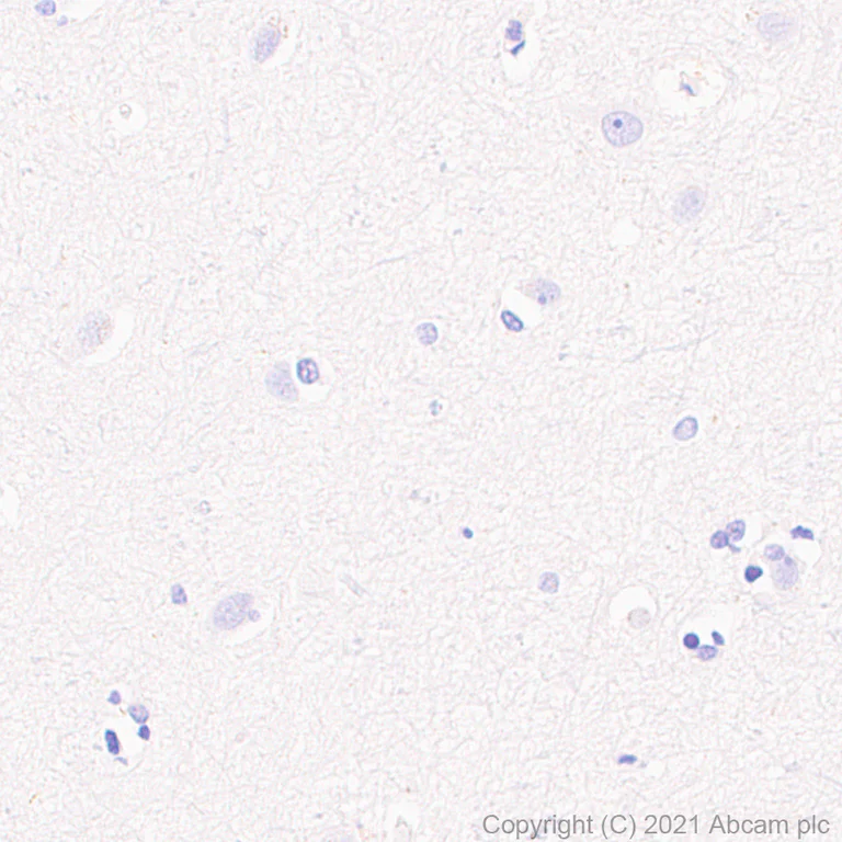 Immunohistochemistry (Formalin/PFA-fixed paraffin-embedded sections) - Anti-MS4A4A antibody [EPR24399-144] - BSA and Azide free (AB281837)