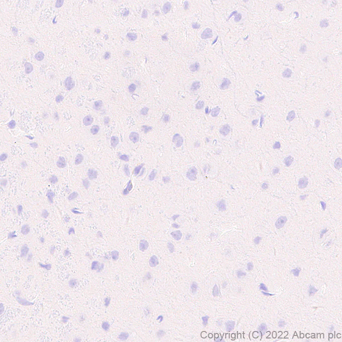 Immunohistochemistry (Formalin/PFA-fixed paraffin-embedded sections) - Anti-MS4A4A antibody [EPR27242-39] (AB307355)