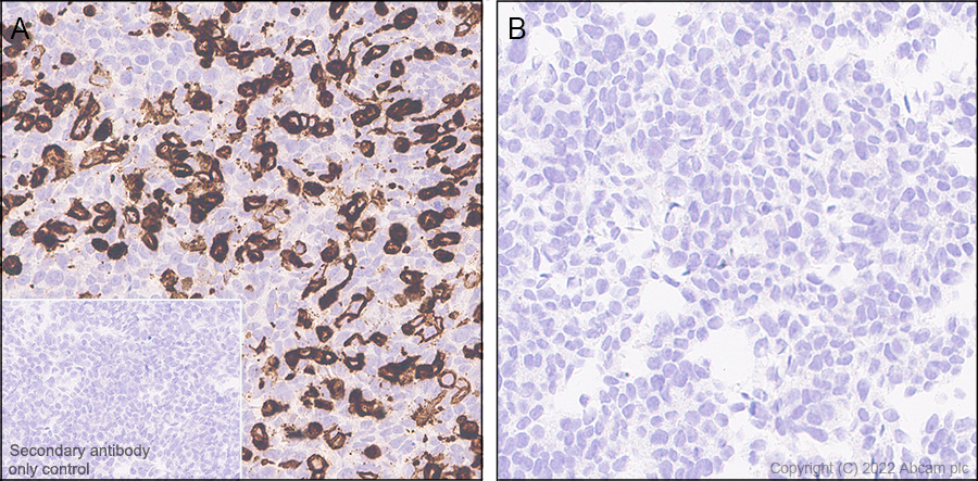 Immunohistochemistry (Formalin/PFA-fixed paraffin-embedded sections) - Anti-MS4A4A antibody [EPR27242-39] - BSA and Azide free (ab307356), expandable thumbnail