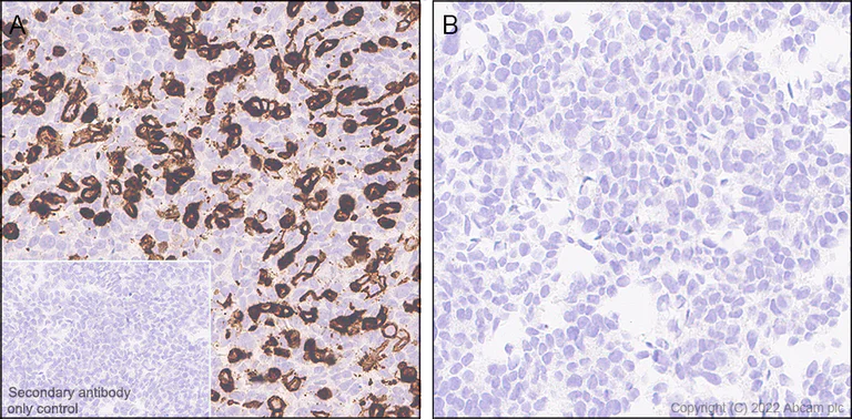 Immunohistochemistry (Formalin/PFA-fixed paraffin-embedded sections) - Anti-MS4A4A antibody [EPR27242-39] - BSA and Azide free (AB307356)