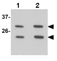 Western blot - Anti-MS4A6A antibody (AB156278)