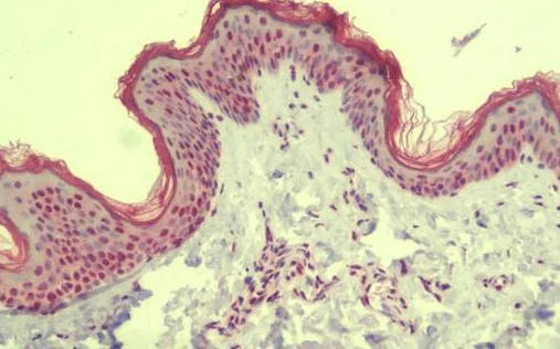 Immunohistochemistry (Formalin/PFA-fixed paraffin-embedded sections) - Anti-MS4A6A antibody - N-terminal (AB189983)