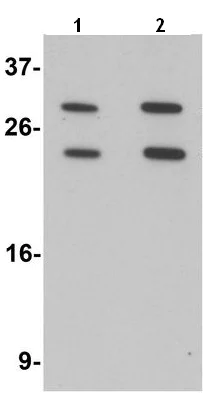 Western blot - Anti-MS4A6A antibody - N-terminal (AB189983)
