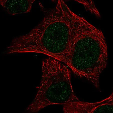 Immunocytochemistry/ Immunofluorescence - Anti-MSC antibody (AB221097)