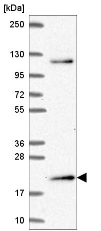 Western blot - Anti-MSC antibody (AB221097)